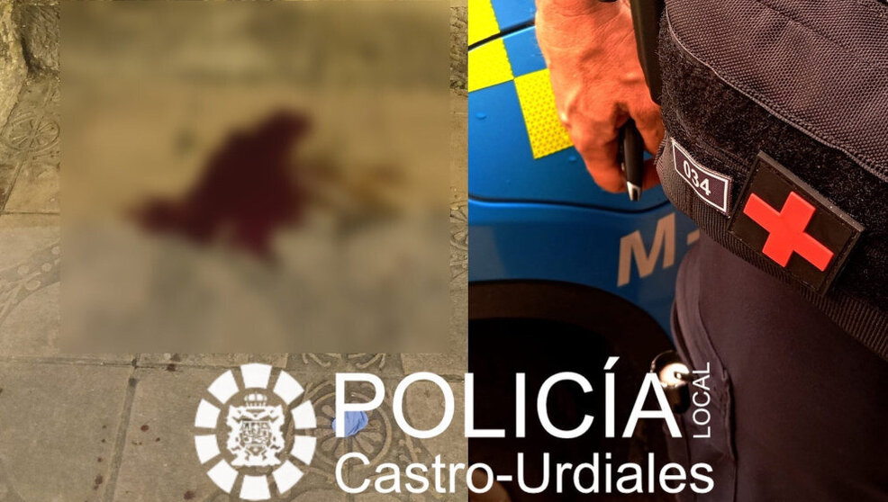 Un detenido por apuñalar a un joven en el estómago en una pelea multitudinaria en Castro